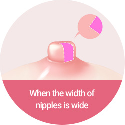 When the width of nipples is wide