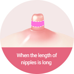 When the length of nipples is long